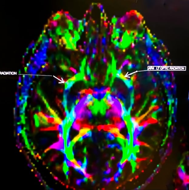 A close-up photo of brain scans highlighting areas associated with positive emotions and stress reduction, illustrating the neurological effects of gratitude practices and their impact on emotional resilience.